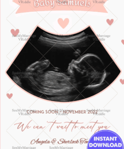 Baby Announcement Card with Baby Ultrasound Image Highlight and Soft Heart Motif